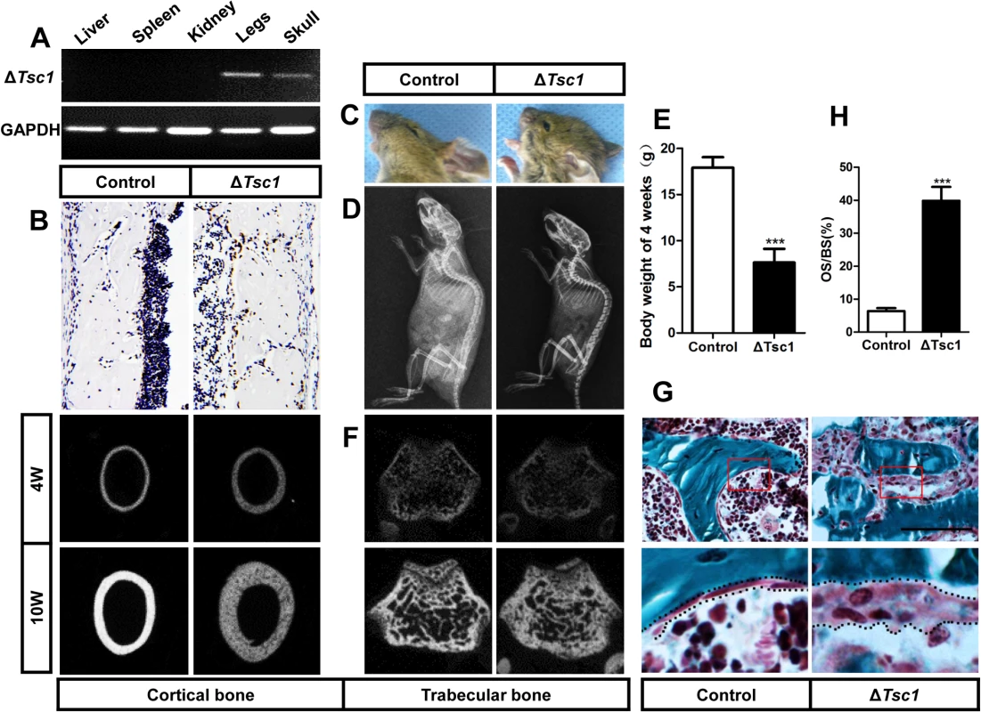 mTORC1 activation in preosteoblasts produces immature woven bone.