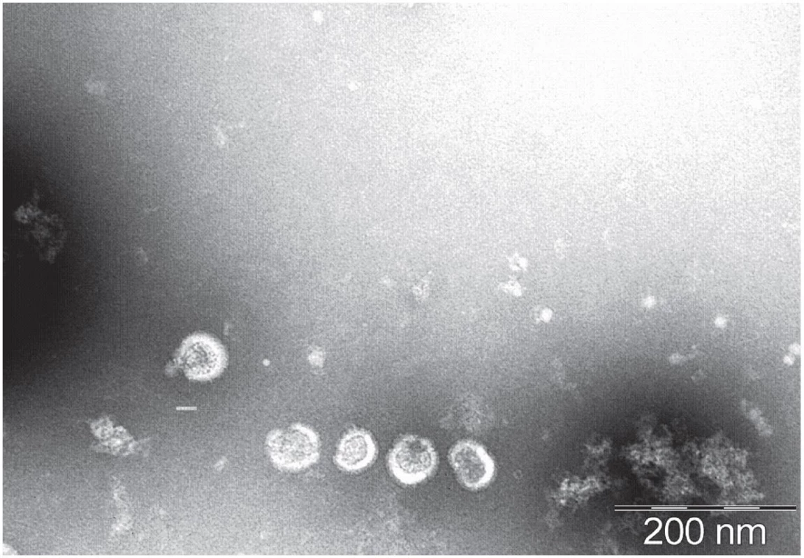 Virus zarděnek v ELMI obraze (autor Mgr. Markéta Pomiklová, ZÚ Ostrava)
Fig. 2. Rubella virus in ELMI (author Mgr. Markéta Pomiklová, ZÚ Ostrava)