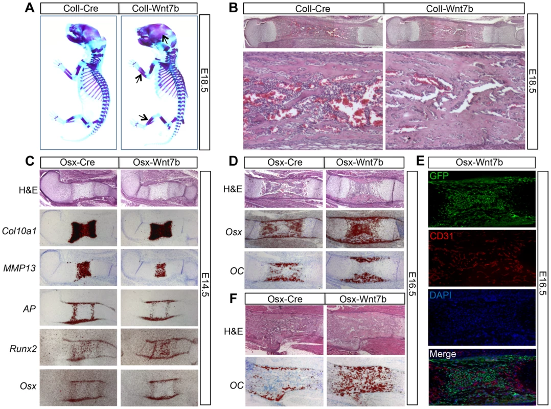 WNT7B stimulates bone acquisition in the embryo.