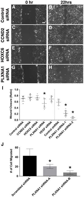 Knockdown of PLXNA1 impairs migration of human ERMS cells.