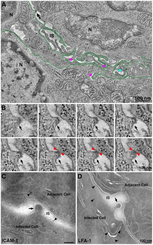 Intercalating infected cell with a budding profile contacting an adjacent cell.