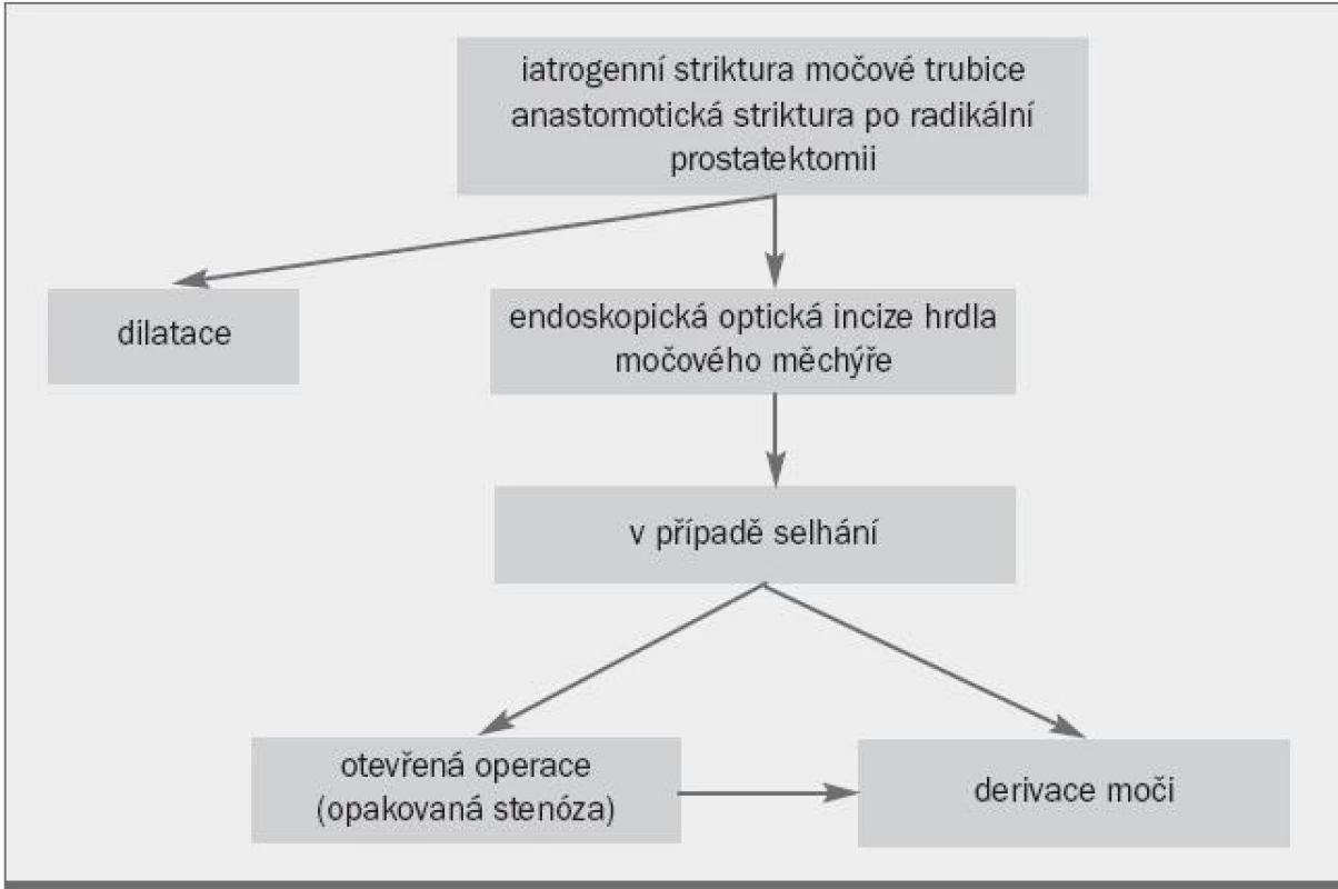 Algoritmus pro léčbu striktury, k níž došlo při radikální prostatektomii.