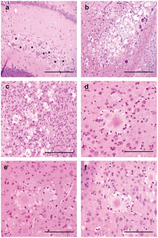 Brain vacuolar changes and amyloid plaques in transgenic mice for the human PRNP gene (methionine 129 variant - tg650).