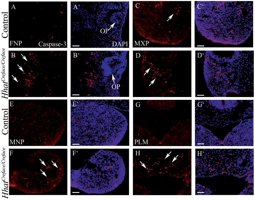 <i>Hhat<sup>Creface/Creface</sup></i> embryos exhibit increased cell death in craniofacial mesenchyme.