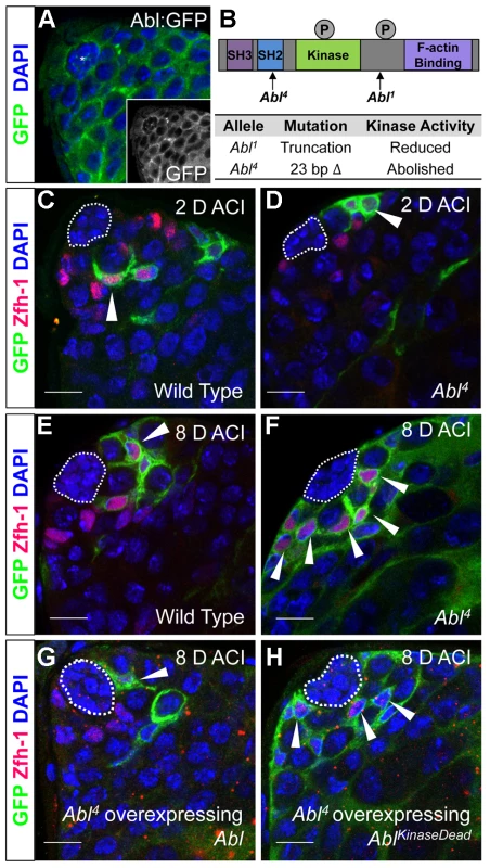 Abl kinase activity is required to prevent CySC overcompetition.
