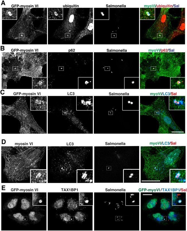Myosin VI localises to autophagosomes containing Salmonella.