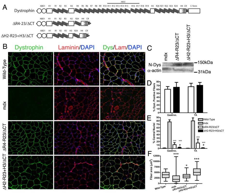 The hinge domains of dystrophin influence muscle maturation and maintenance.