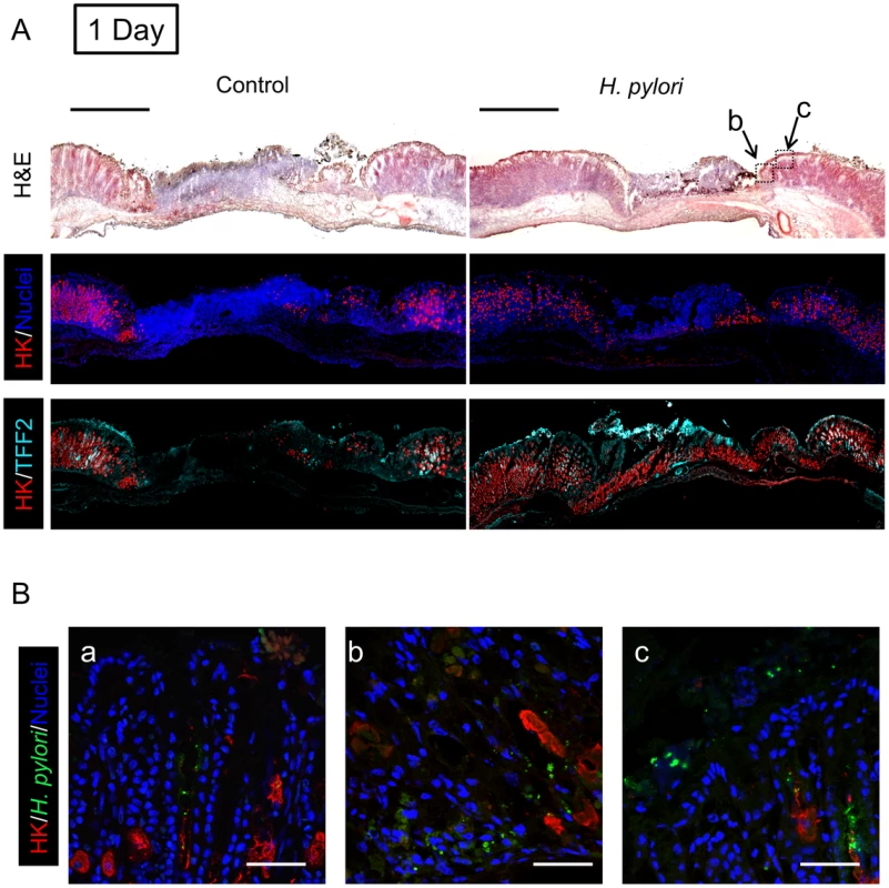 Morphology of gastric ulcerated tissue 1 day after <i>H. pylori</i> inoculation.