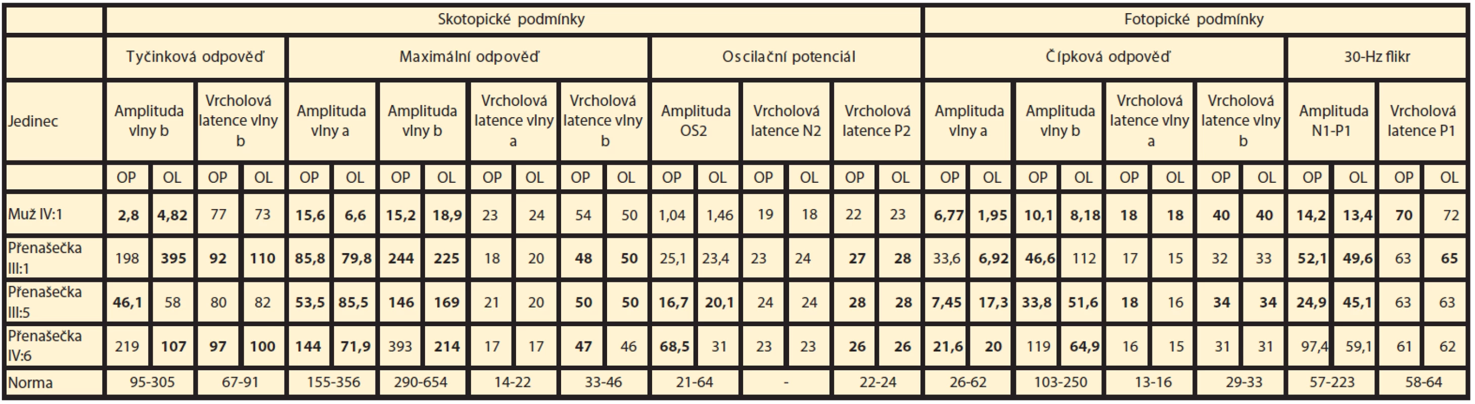 Hodnoty zaznamenané při elektrofyziologickém vyšetření sítnice. Výsledky zjištěné u muže IV:5 s již vyhaslou elektrickou aktivitou sítnice nejsou uvedeny. Hodnoty amplitud jsou uvedeny v μV, hodnoty latencí v ms, tučně jsou zvýrazněny patologické hodnoty