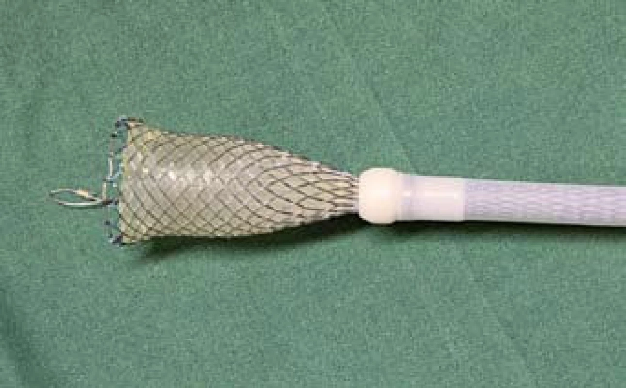 Zavinování stentu do extraktoru.
Fig. 13. Binding a stent to the extractor.