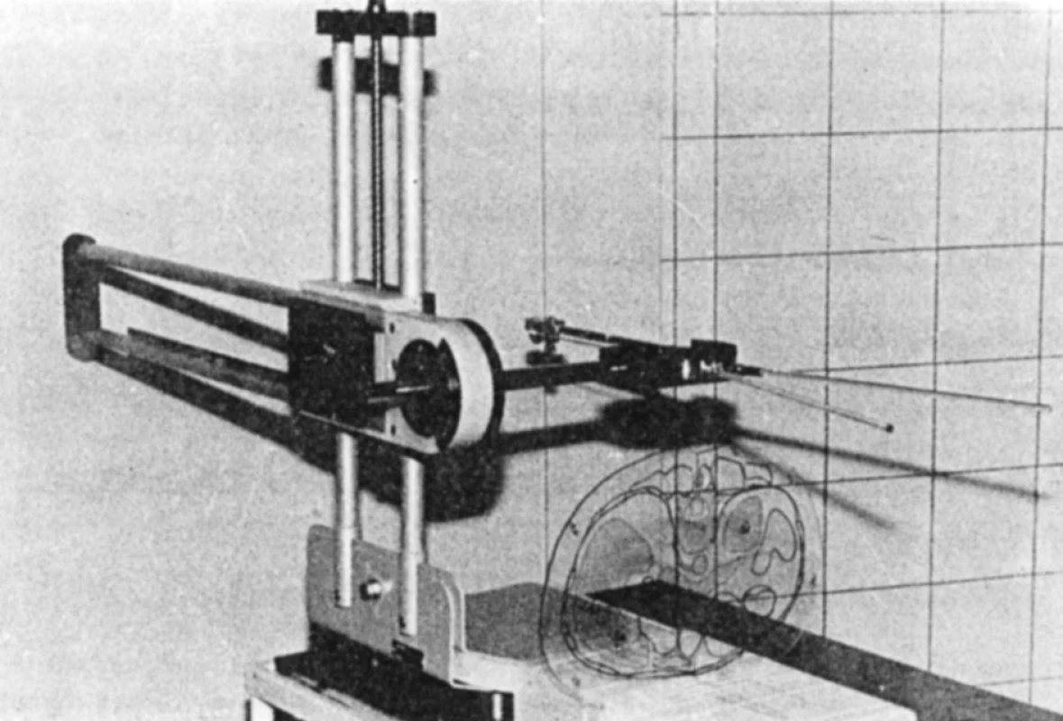 Celotělové cílící zařízení před modelovou operací
Fig. 2. The whole-body navigation apparatus prior to the model surgical procedure