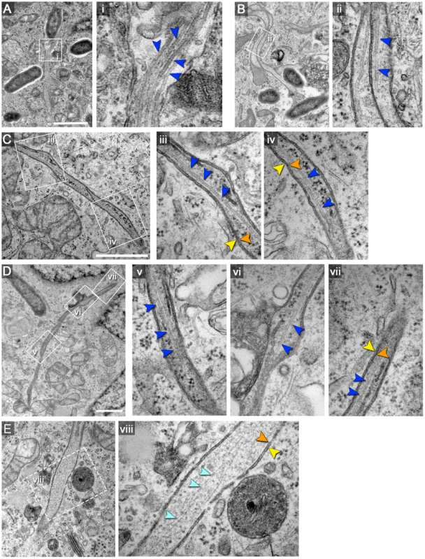 Double membrane SIT contain cytoskeletal filaments and ribosomes.
