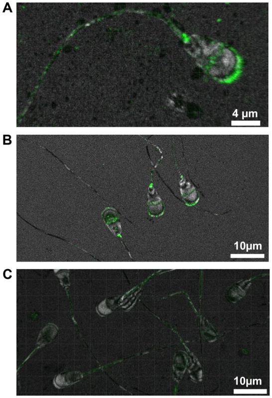Immunohistochemical localisation of TMEM95.