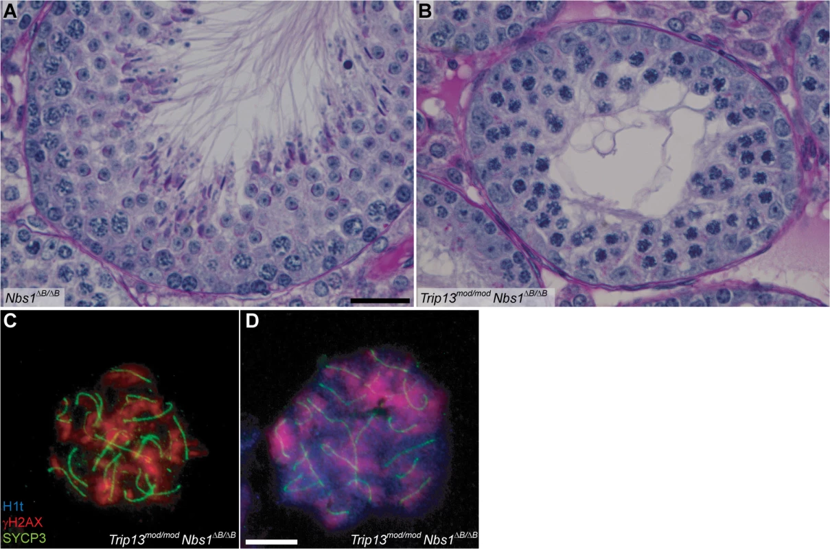 <i>Trip13</i><sup><i>mod/mod</i></sup> <i>Nbs1</i><sup><i>ΔB/ΔB</i></sup> spermatocytes arrest in mid/late pachynema with unrepaired DSBs at epithelial stage IV.
