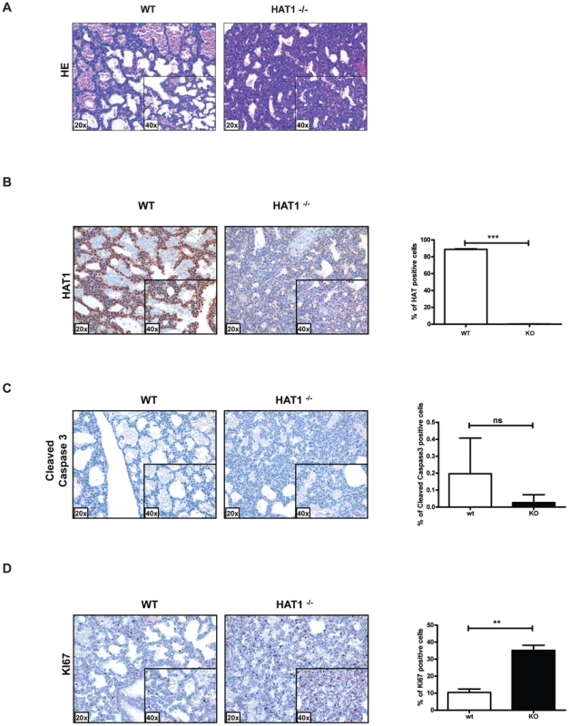 Developmental lung defects result in neonatal death in the absence of Hat1.