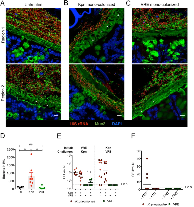 Differential mucus layer infiltration and translocation by VRE and K. <i>pneumoniae</i>.