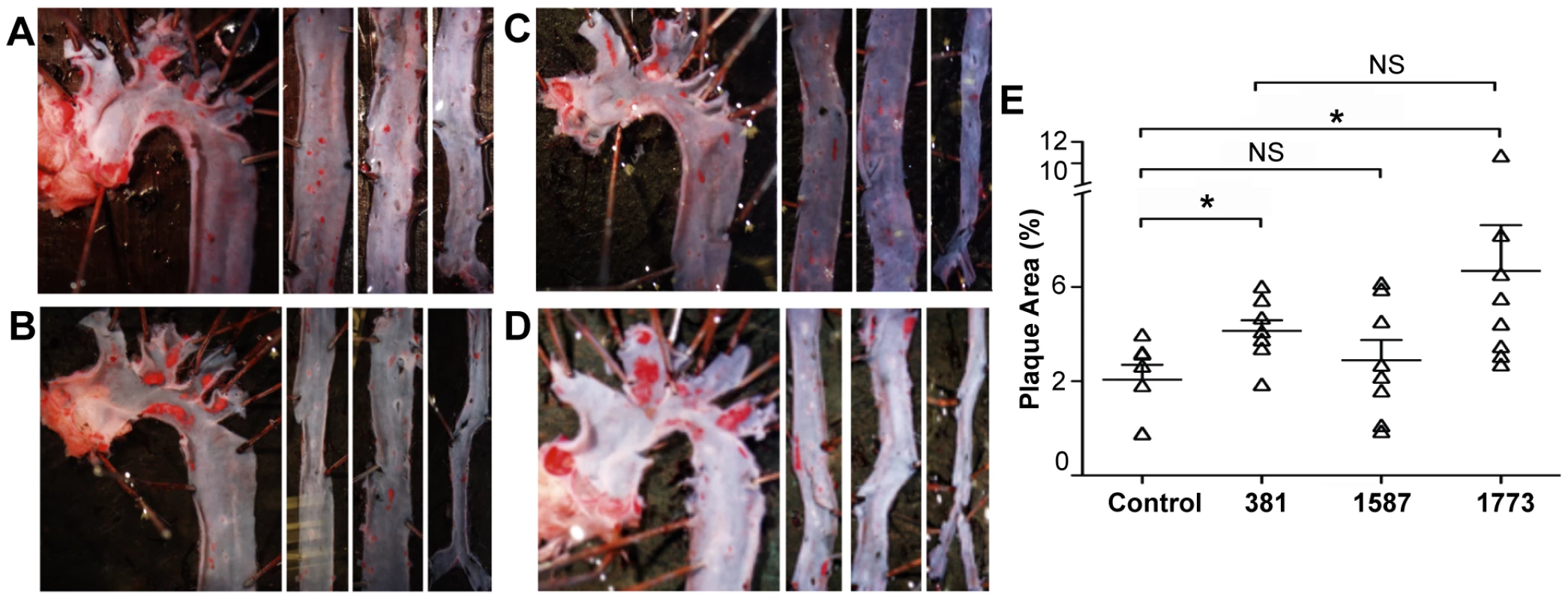 Expression of immunologically silent or antagonistic lipid A structures exacerbates atherosclerotic plaque progression in the aorta.