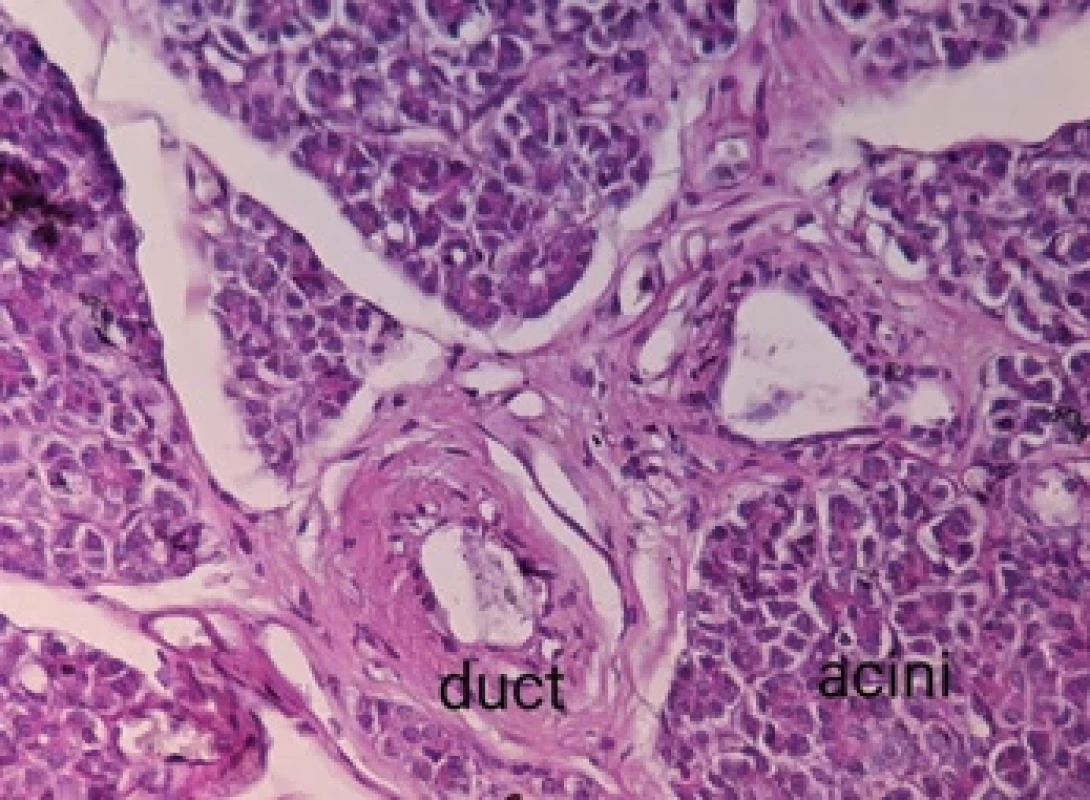 High-power view of the heterotopic pancreatic tissue showing acini and duct.