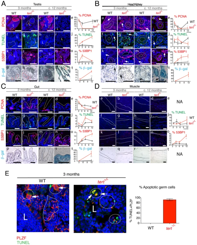 Proliferative tissue degeneration is accompanied by a sustained decrease in proliferation, acute apoptotic responses, and progressive accumulation of DDR foci.