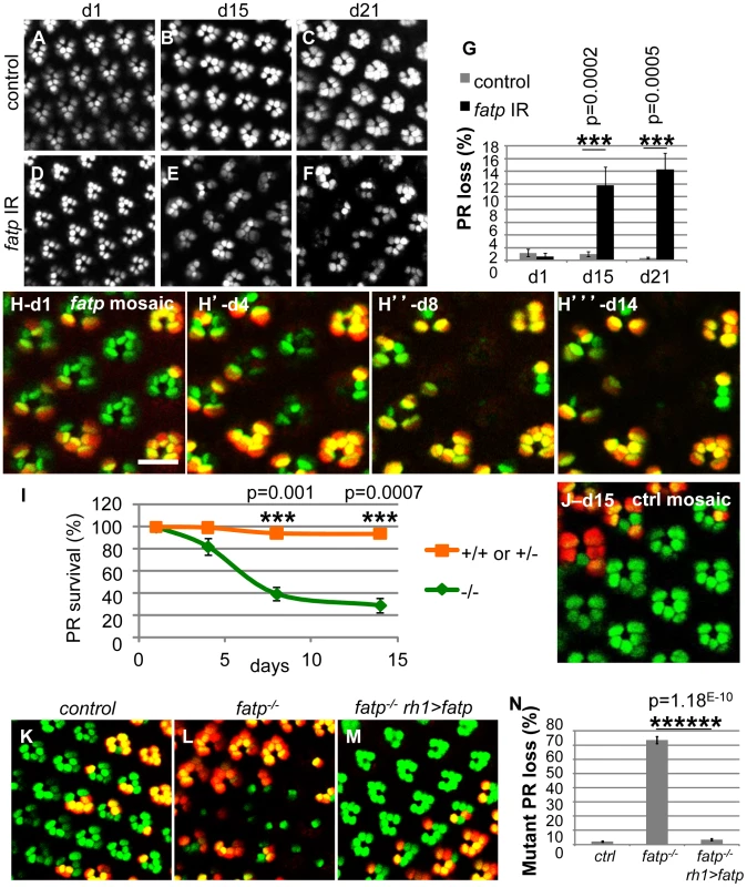 Loss of <i>fatp</i> induces adult-onset progressive degeneration of PRs.
