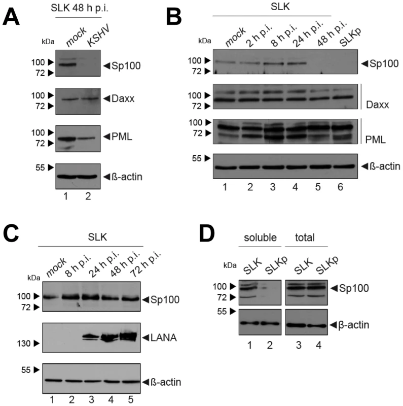 Soluble Sp100 levels are reduced upon KSHV infection of SLK cells.