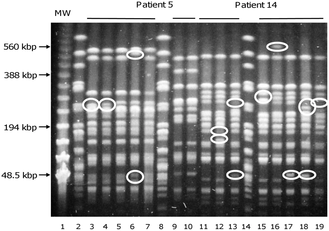 Pulsed-field gel electrophoresis resolving <i>Xba</i>I restriction fragments from <i>E. coli</i> isolates.