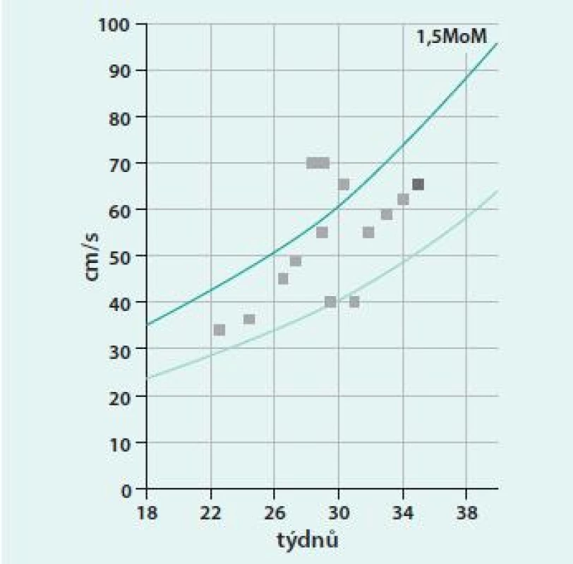 Dopplerovské sledování senzibilizovaného těhotenství v porodnické databázi ASTRAIA. Upraveno podle [6].