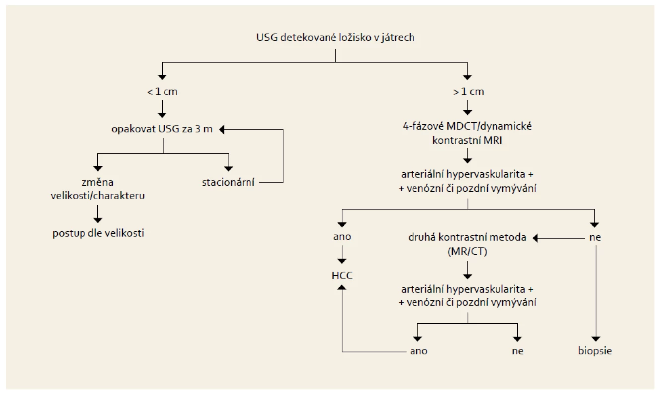 Postup u pacienta s nálezem ložiska v játrech v rámci sonografického screeningu HCC.
Fig. 1. Diagnostic algorithm in patient with liver nodule detected due to ultrasound screening for HCC.