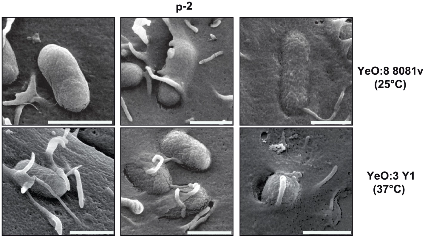 <i>Y. enterocolitica</i> O:3 and O:8 interaction with epithelial cells.