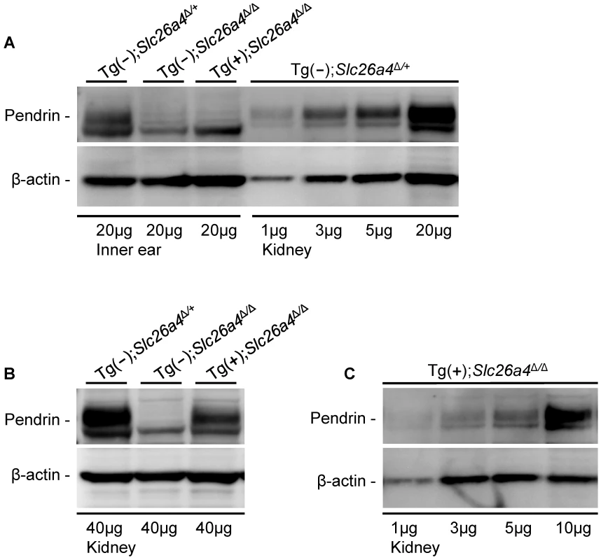 Pendrin expression evaluated by Western blotting.