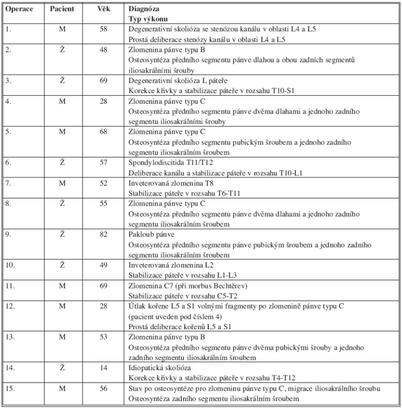 Přehled diagnóz a typů operačních výkonů u pacientů sledovaného souboru
Tab. 1: Diagnosis and type of surgery performed in studied patients