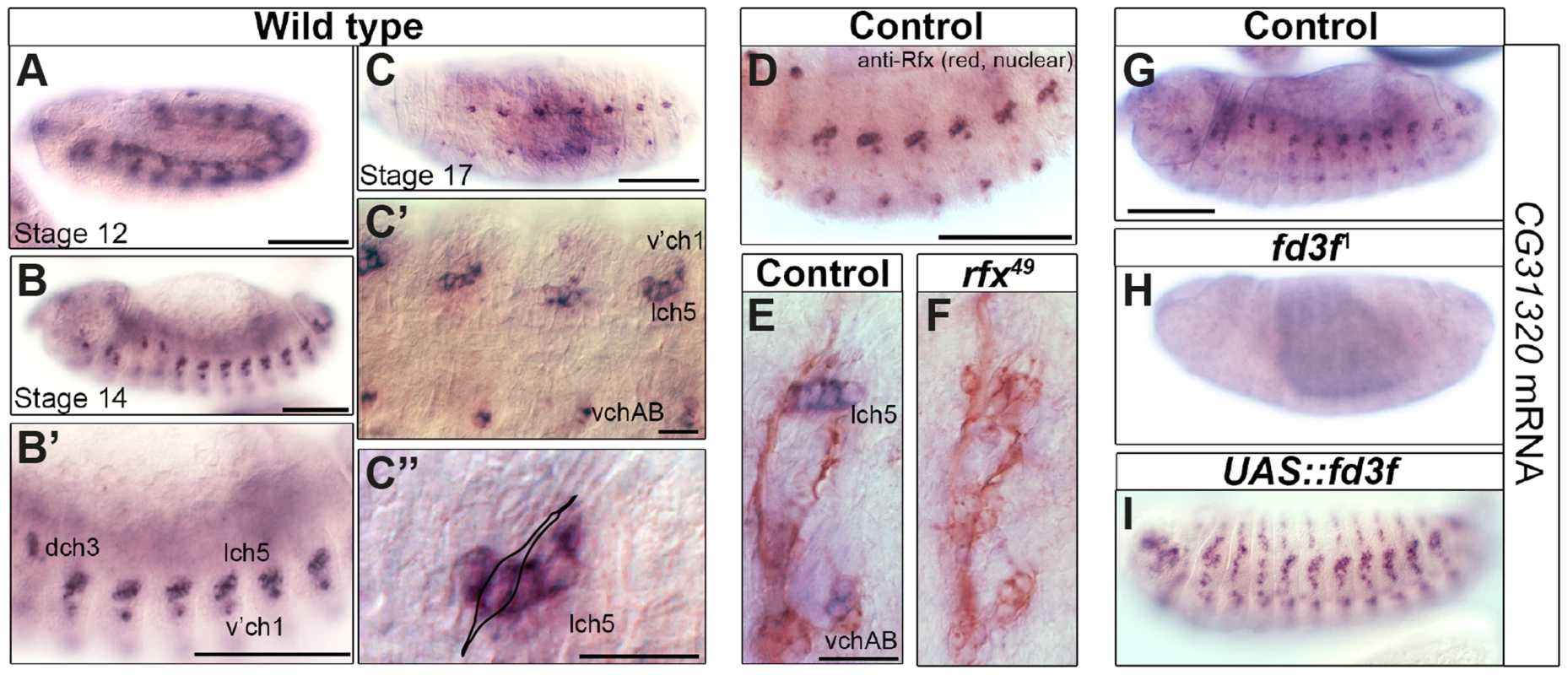The <i>HEATR2</i> orthologue <i>CG31320</i> is highly expressed in motile ciliated mechanosensory Ch neurons in an Rfx- and Fox-dependent manner.