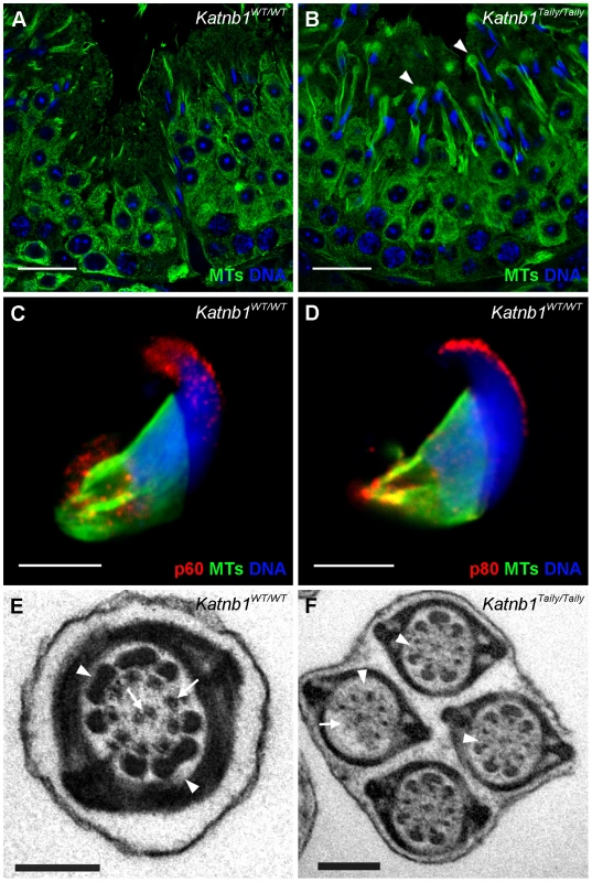 Katanin localization to manchettes and abnormalities in manchette resolution and flagella structure in <i>Katnb1<sup>Taily/Taily</sup></i> spermatids.