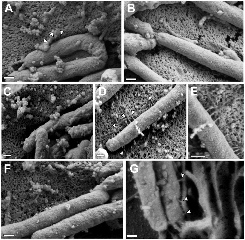 Role of CagI and CagL in pilus formation.