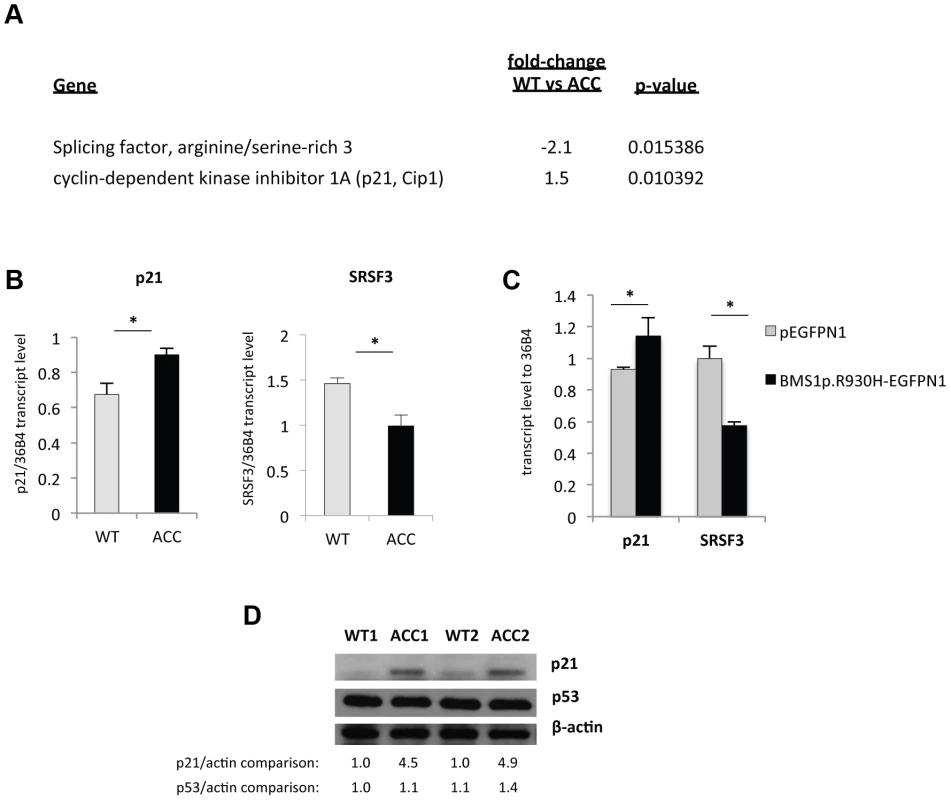 An increase in p21 levels in ACC skin fibroblasts.