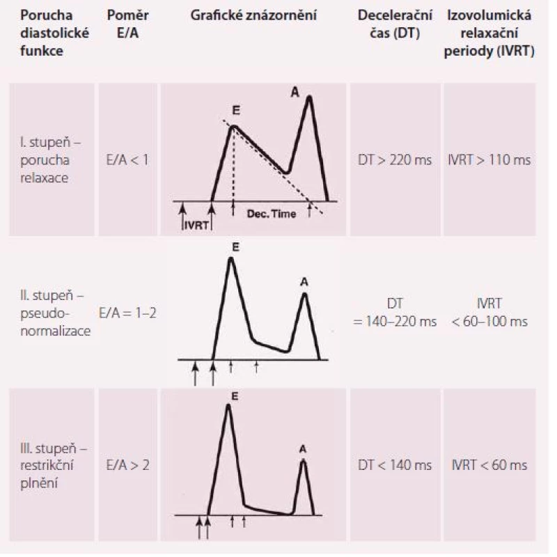Hodnocení diastolické dysfunkce pomocí pulzní Dopplerovské echokardiografie.