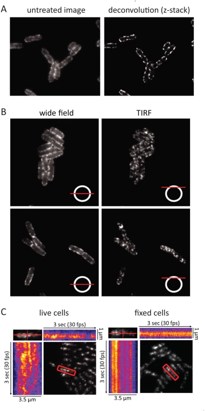 RNase E localization and mobility. Images are of the KSL2000/pVK207 strain, which expresses RNase E-YFP.