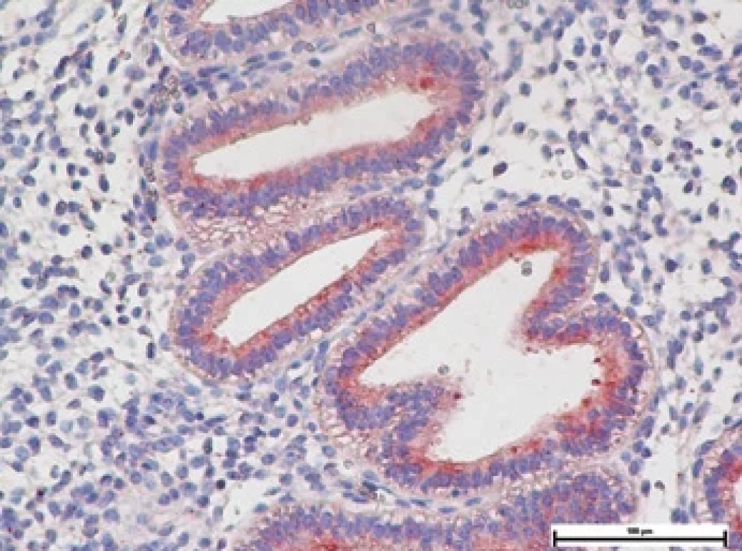 Tissue kisspeptin immunohistochemical staining image in a control patient (the pink stained areas indicated by the red arrow are kisspeptin-dense areas).