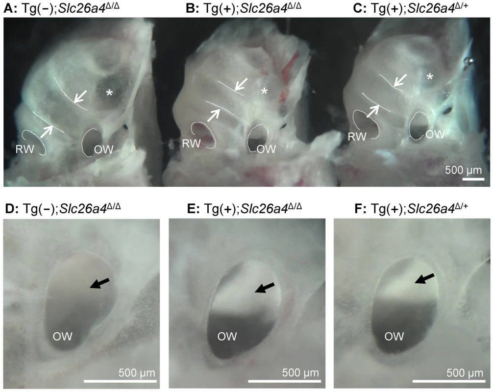 Gross morphology of the cochlea isolated by microdissection.