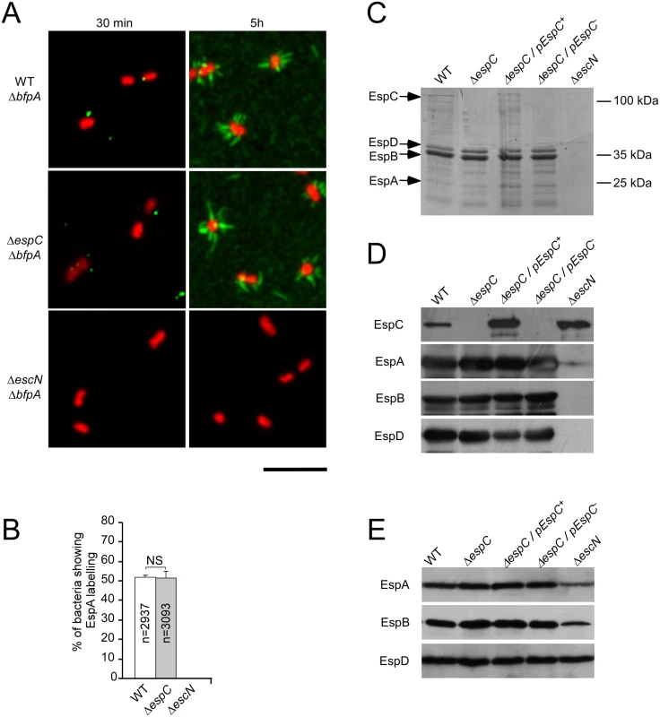 EspC does not regulate EspA filament structures at the surface of primed bacteria.