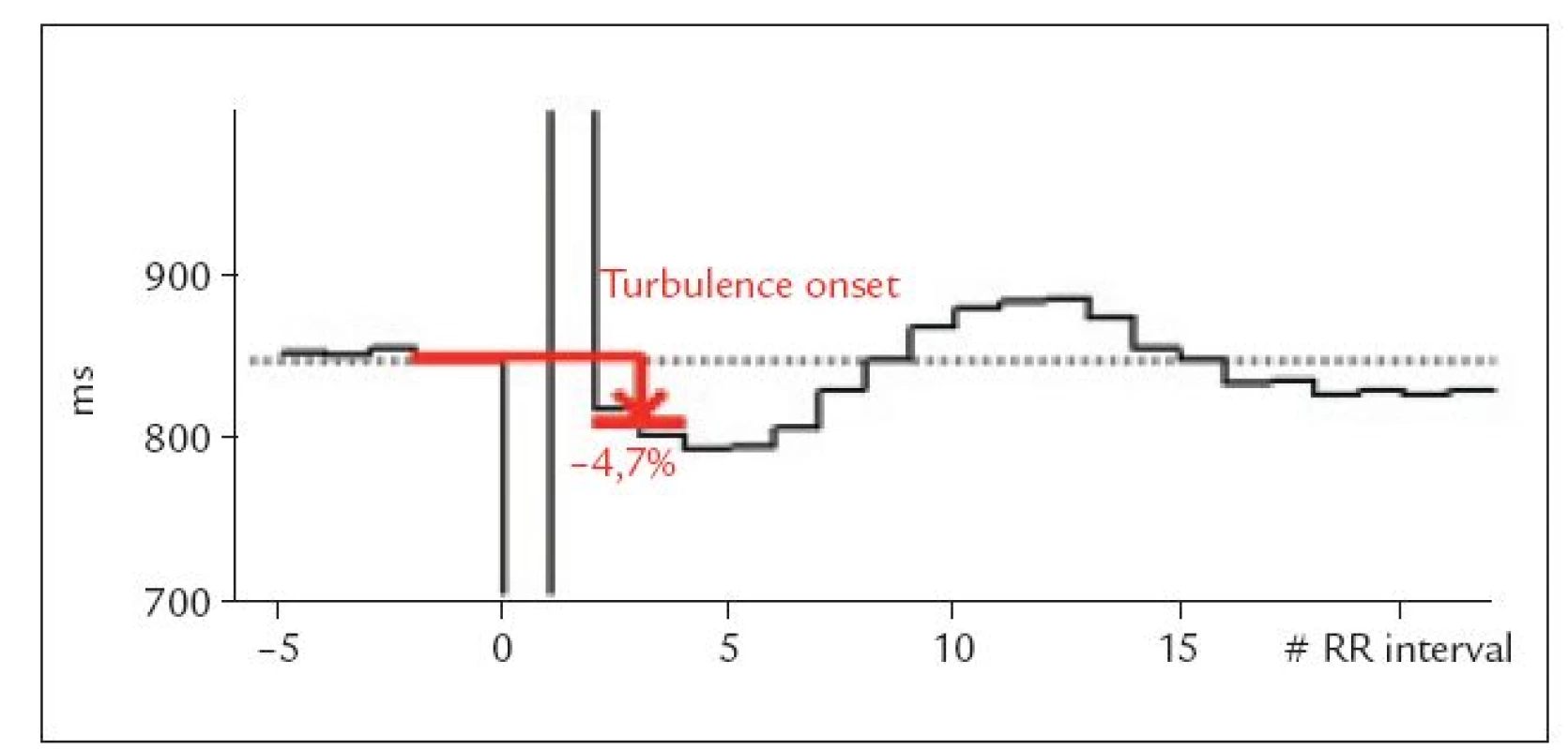 HRT – stanovení parametru TO.