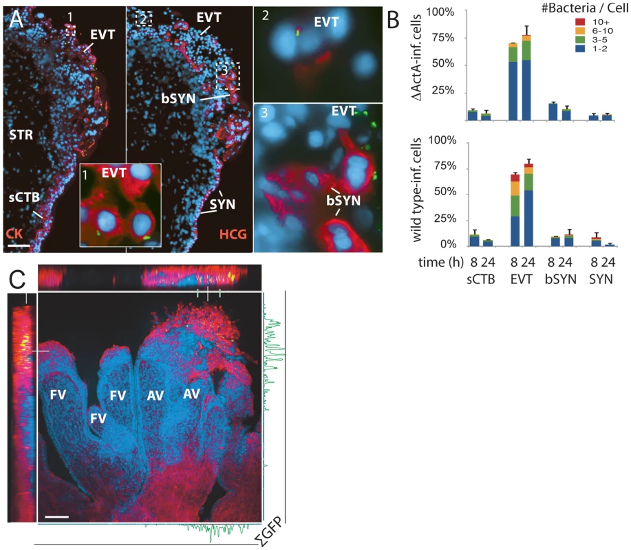 <i>L. monocytogenes</i> enters the placenta primarily at invasive villus tips.