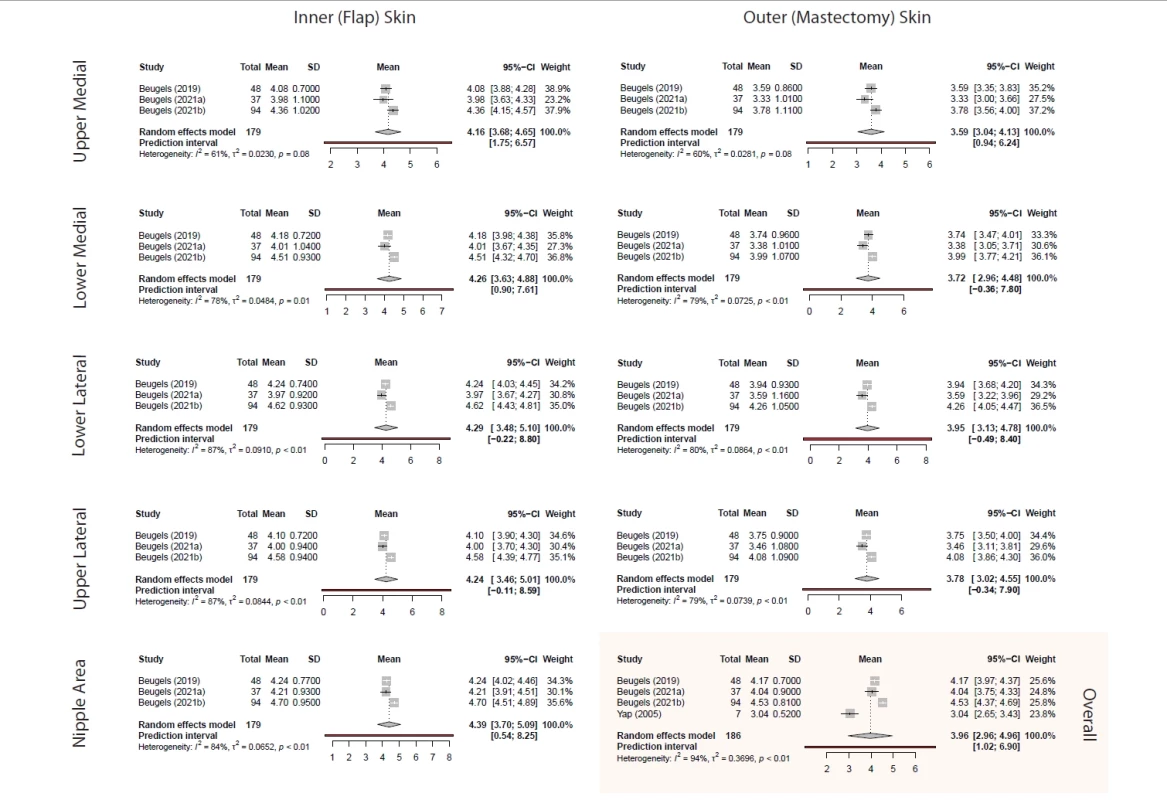 Forest plot for area-specifi c SMWT rod size in breasts with end-to-end nerve coaptation in 179 patients across three studies. Pooled SMWT rod size was generally lower in outer (mastectomy) skin: 3.59 (95% CI 3.04; 4.13) for upper medial, 3.72 (95% CI 2.96; 4.48) for lower medial, 3.95 (95% CI 3.13; 4.78) for lower lateral, and 3.78 (95% CI 3.02; 4.55) for upper lateral sections. Pooled SMWT rod size for inner (fl ap) skin was found to be 4.16 (95% CI 3.68; 4.65) for upper medial, 4.26 (95% CI 3.63; 4.88) for lower medial, 4.29 (95% CI 3.48; 5.10) for lower lateral, 4.24 (95% CI 3.46; 5.01) for upper lateral, and 4.39 (95% CI 3.70; 5.09) for nipple sections.