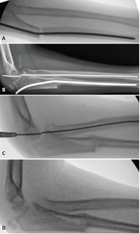  / Fig. 3.