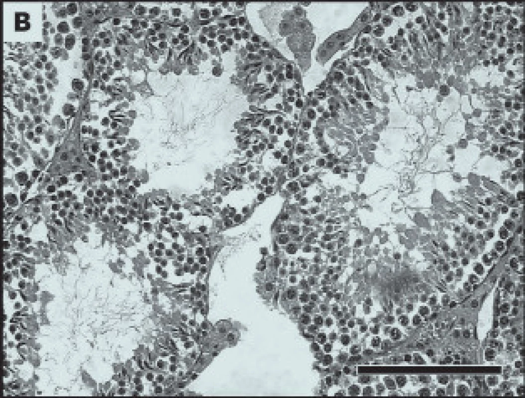 Vliv bisfenolu A na spermatogenesi.
Tkáňové řezy testes. Kontrolní skupina bez ovlivnění (A) a experimentální po ovlivnění bisfenolem A (B).