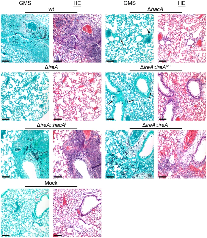 Histopathology of infected lung tissue.
