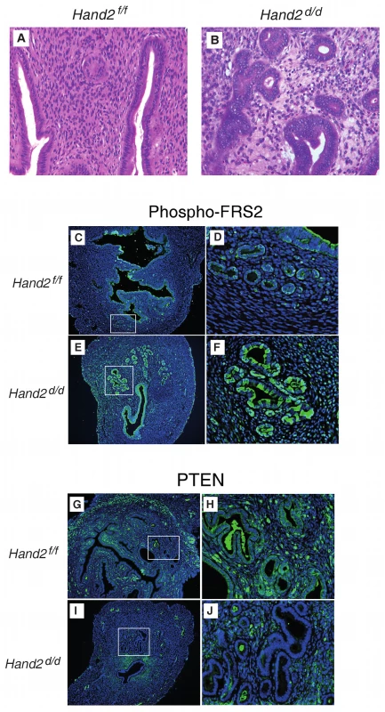 Endometrial pre-invasive neoplastic changes in <i>Hand2</i> conditional knock-out mice.