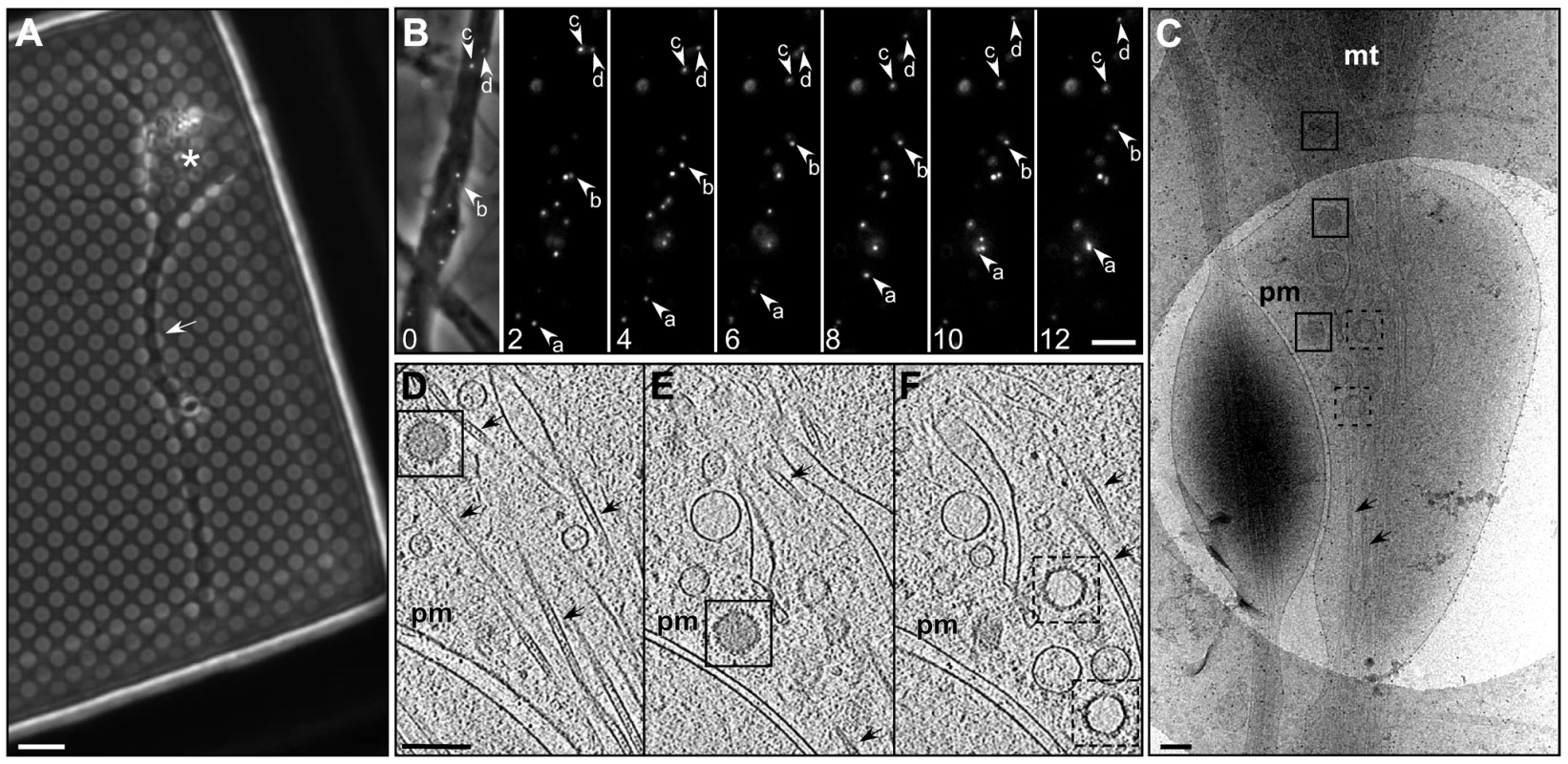 Transport of HSV1 capsids in neurons during egress.