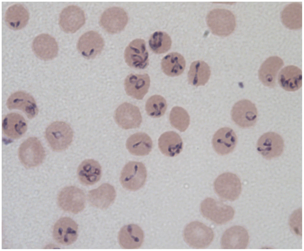 Different forms of <i>Babesia divergens</i> in human RBCs as seen on a Giemsa-stained smear from <i>in vitro</i> cultured parasites (ring, dividing figure eights, Maltese cross parasites, and multiply infected RBCs).