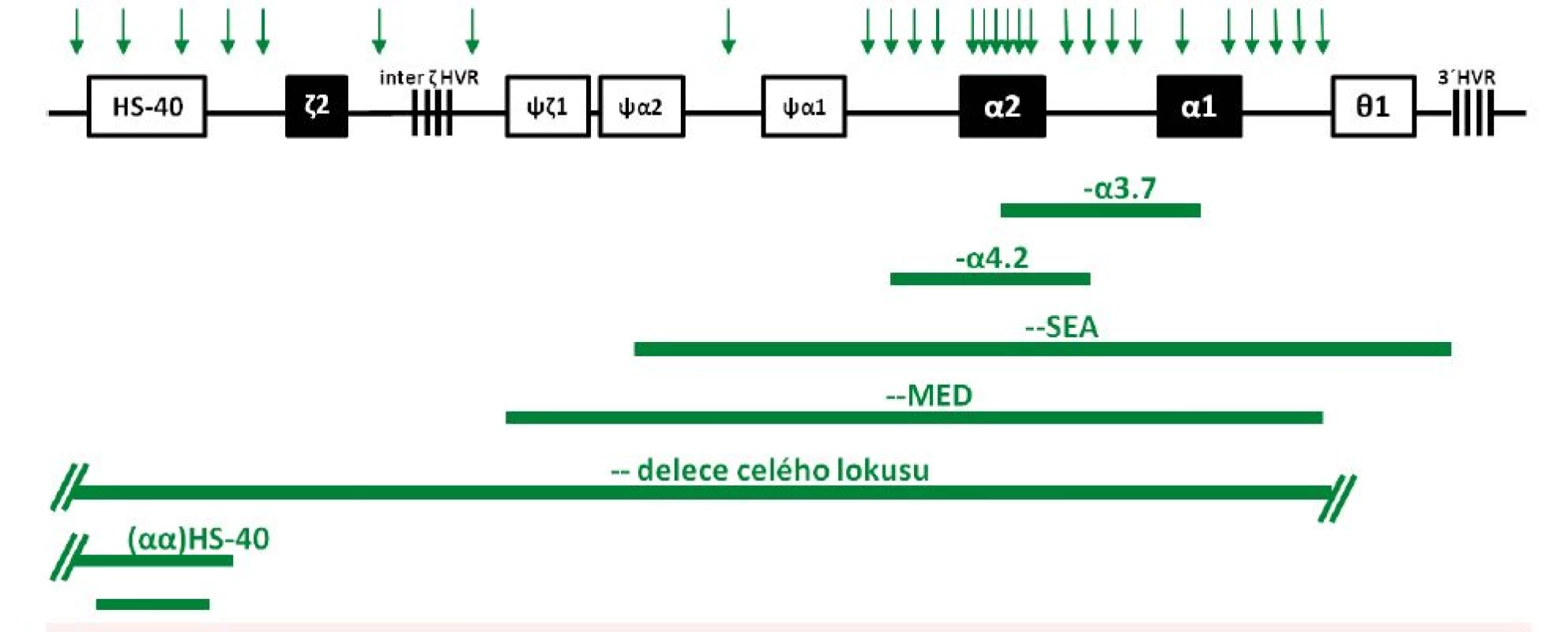 Schematické znázornění delecí <i>HBA</i> lokusu zjištěných v České republice u českých rodin a u rodin cizinců Delece – –<sup>MED</sup>, delece celého lokusu a různě dlouhé delece regulační oblasti HS-40 jsou u nás popsány poprvé v tomto sdělení. Vysvětlení genů a pseudogenů v lokusu – viz obr. 2A. HVR značí tzv. hypervariabilní oblasti v <i>HBA</i> lokusu. Vertikální šipky nad lokusem značí polohy MLPA prób použitých pro mapování delecí (viz Diagnóza a diagnostické metody).